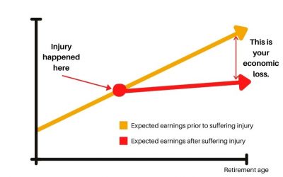 All about economic loss in WorkCover matters